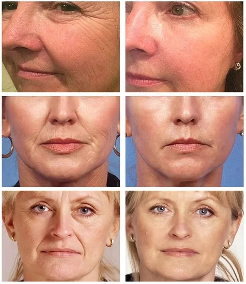BounceLift Stick – Smooth Wrinkles Instantly / WrinkleAway Balm – Instant Lift & Moisture