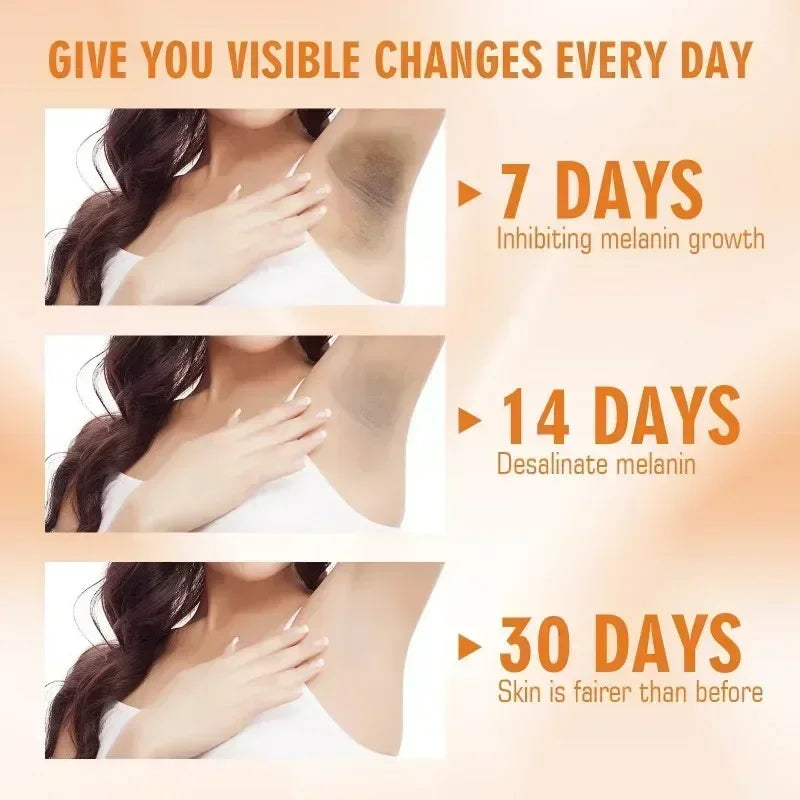 GlowUp Cream – Brighten Intimate & Dark Spots Fast / Whitening Cream for Intimate & Underarm Areas – Smooth & Confident Skin