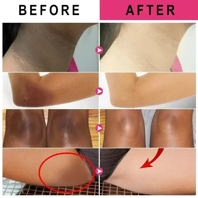 GlowUp Cream – Brighten Intimate & Dark Spots Fast / Whitening Cream for Intimate & Underarm Areas – Smooth & Confident Skin