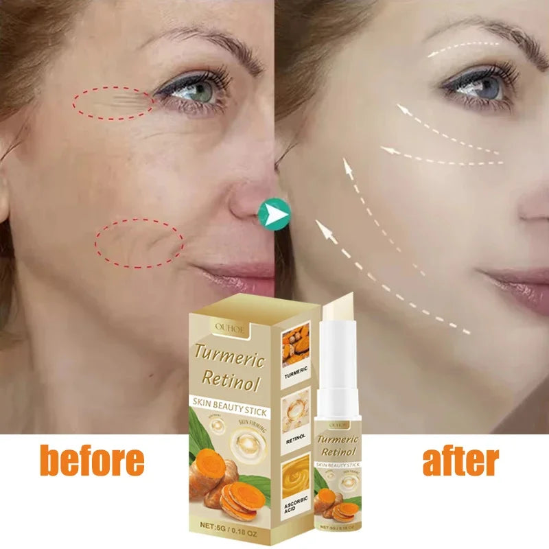 BounceLift Stick – Smooth Wrinkles Instantly / WrinkleAway Balm – Instant Lift & Moisture