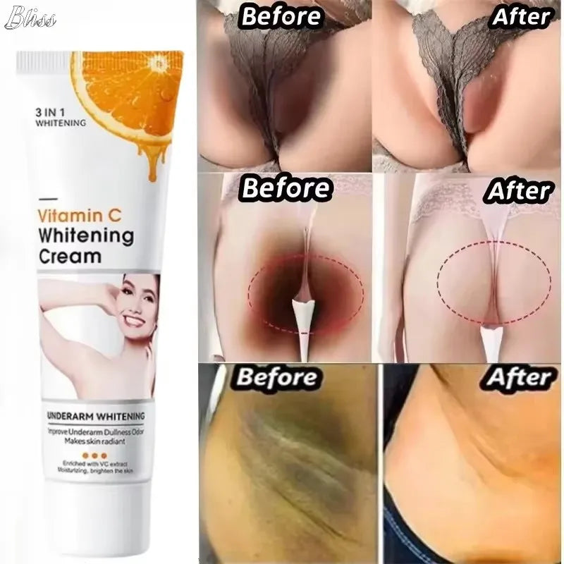 GlowUp Cream – Brighten Intimate & Dark Spots Fast / Whitening Cream for Intimate & Underarm Areas – Smooth & Confident Skin