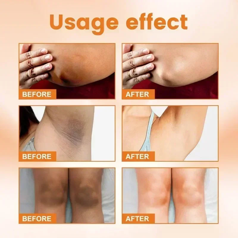 GlowUp Cream – Brighten Intimate & Dark Spots Fast / Whitening Cream for Intimate & Underarm Areas – Smooth & Confident Skin